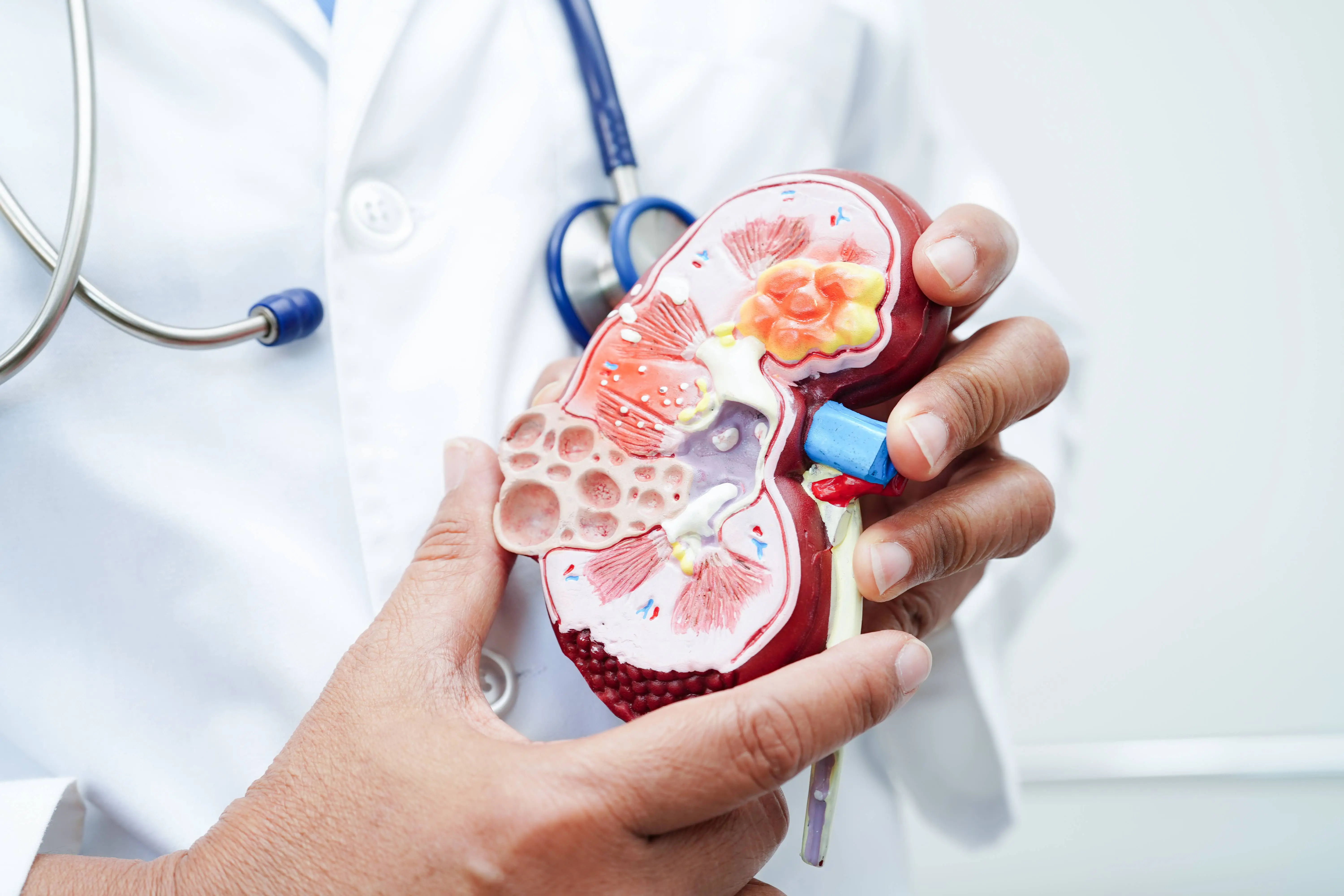 Kidney Check-Up